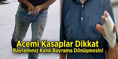 Acemi Kasaplar Dikkat, Bayramınız Kanlı Bayrama Dönüşmesin!