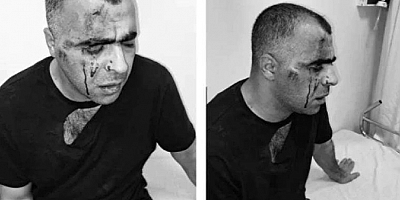Saldırıya uğrayan gazeteci: Susmayacağız, siz haramiler geri adım atacaksınız